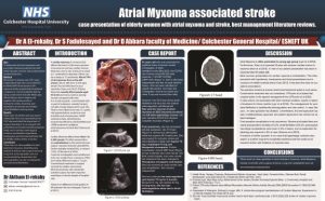 Cardia Myxoma associated stroke - EoE stroke forum poster